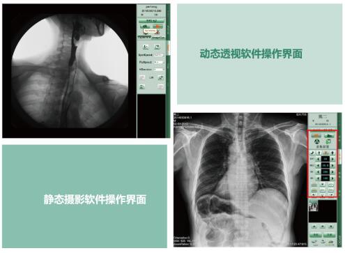 動(dòng)態(tài)dr