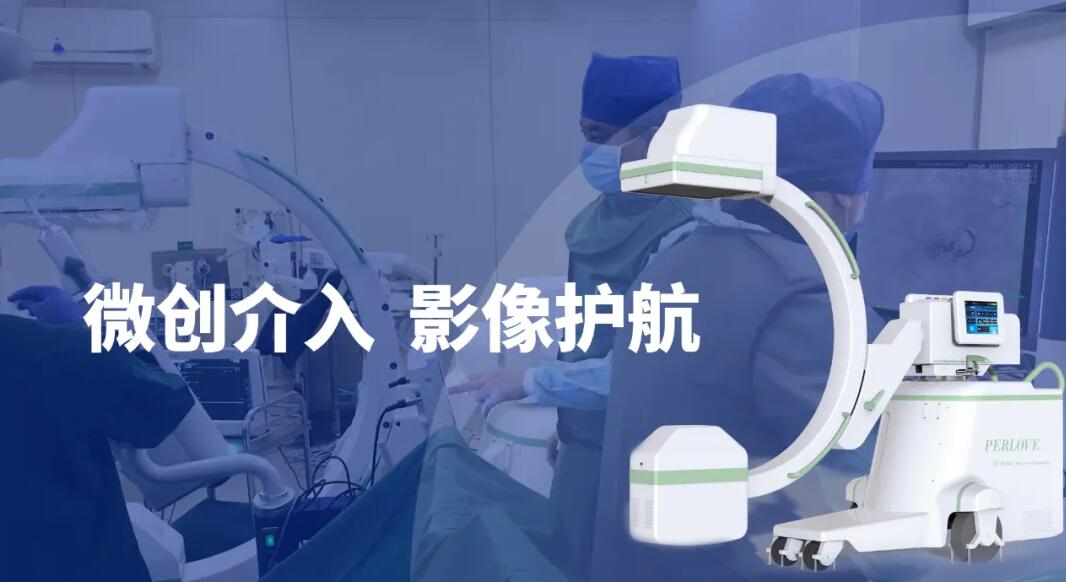 高清影像介入c臂機助力微創介入手術更成功