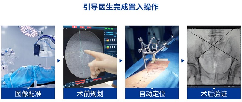 骨科手術機器人標準化流程